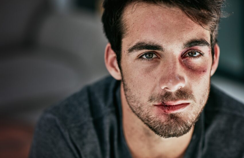 Cropped portrait of a beaten and bruised young man looking down